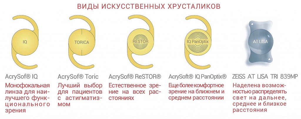 виды искусственных хрусталиков
